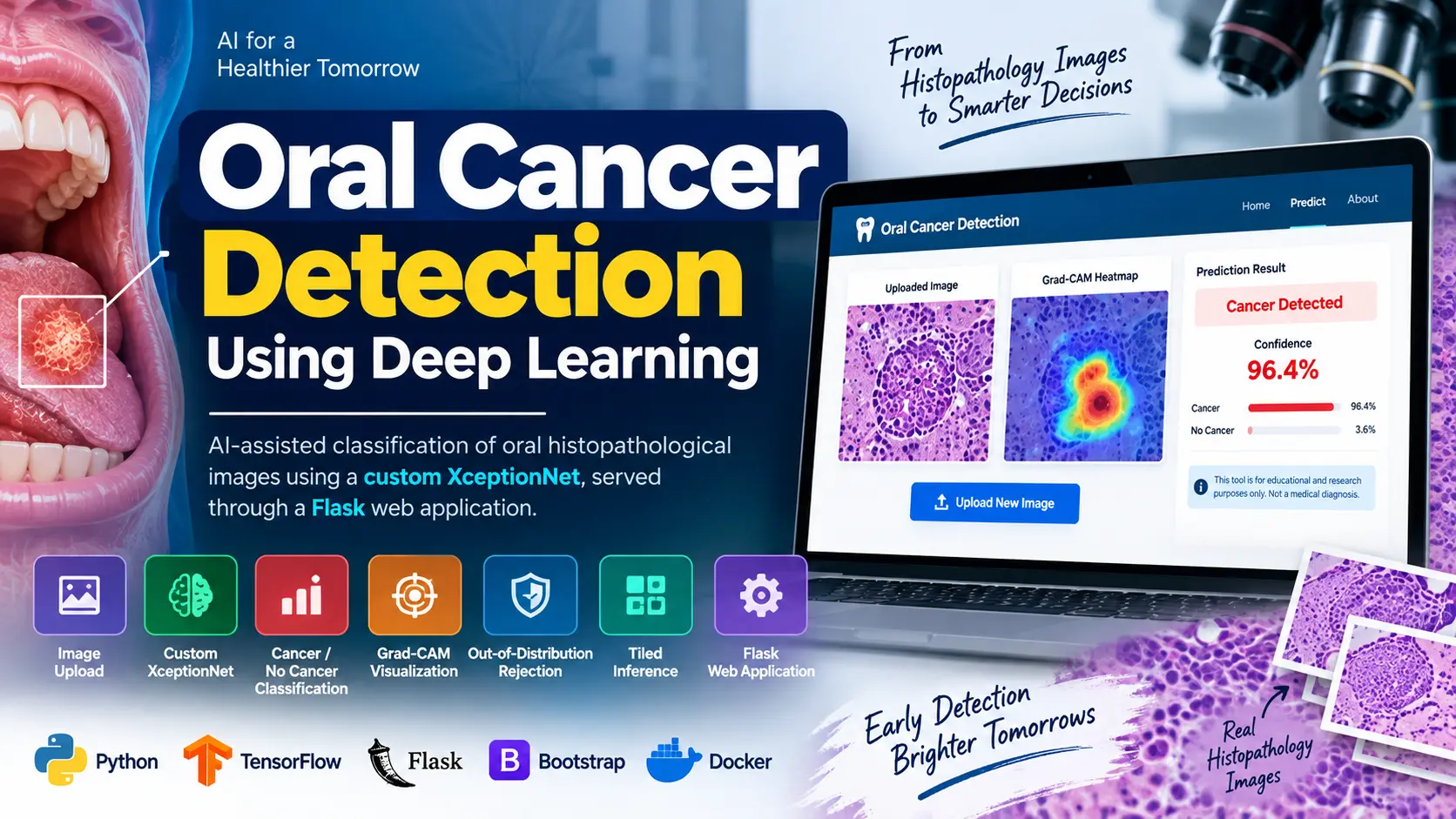Oral Cancer Detection Using Deep Learning